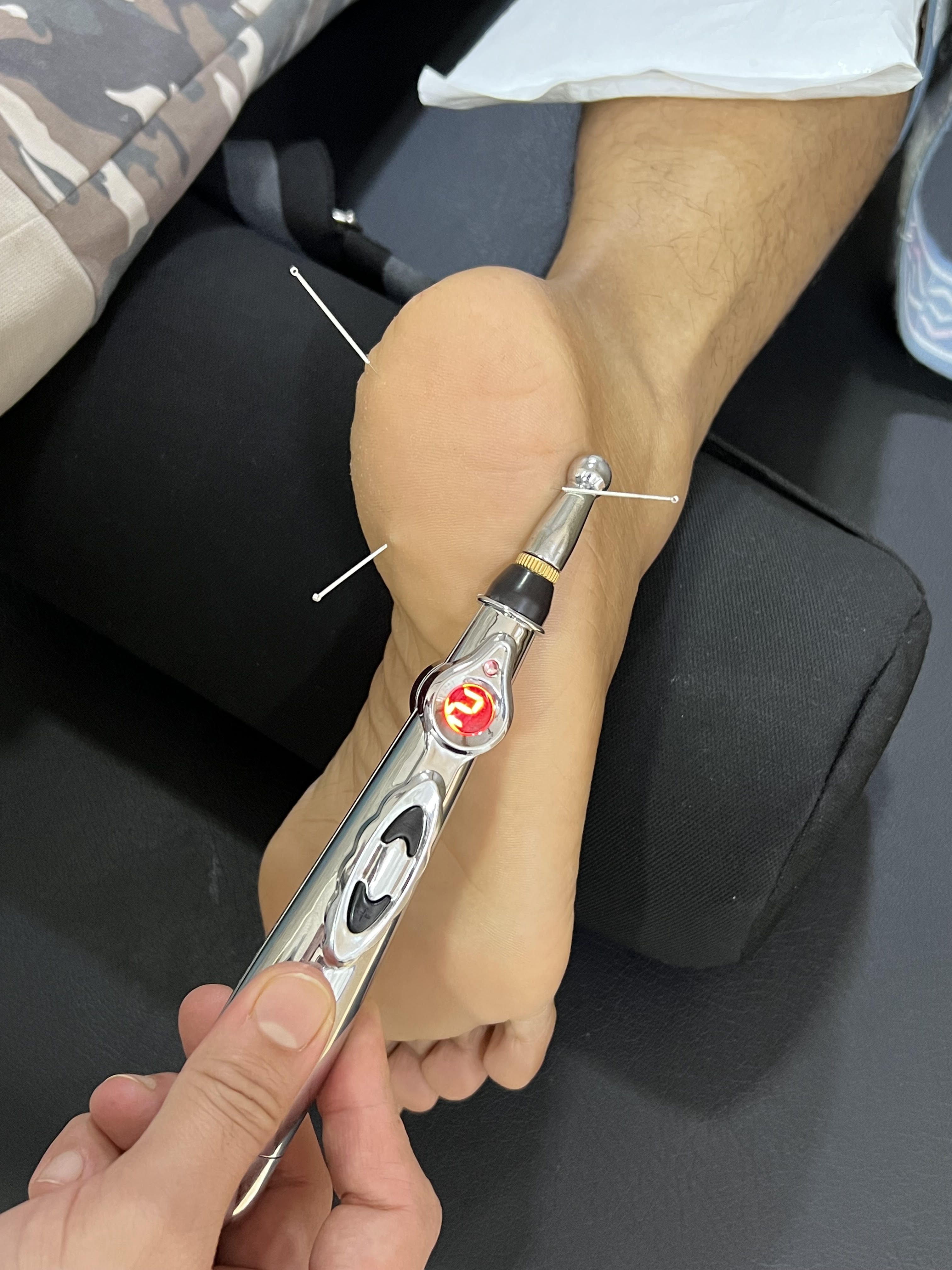 Electro-Acupuncture & Fascial Release